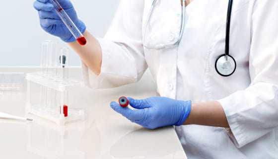 Hematologia – czym zajmuje się hematolog i kiedy warto zgłosić się na konsultację?