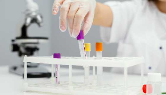 Pakiety badań laboratoryjnych – jakie warto wykonać? Pakiety diagnostyczne w OpenMed