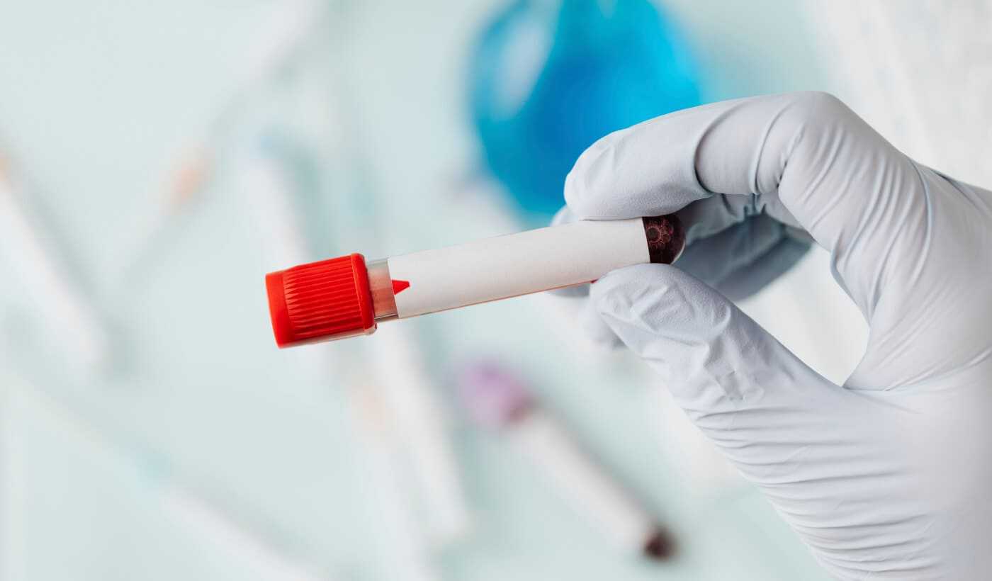 Diagnostyka zaburzeń krzepnięcia Warszawa Wola i Płock | OpenMed