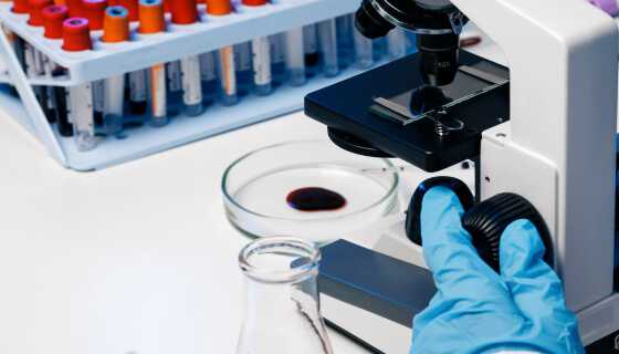 Małopłytkowość – przyczyny, objawy i diagnostyka obniżonej liczby płytek krwi