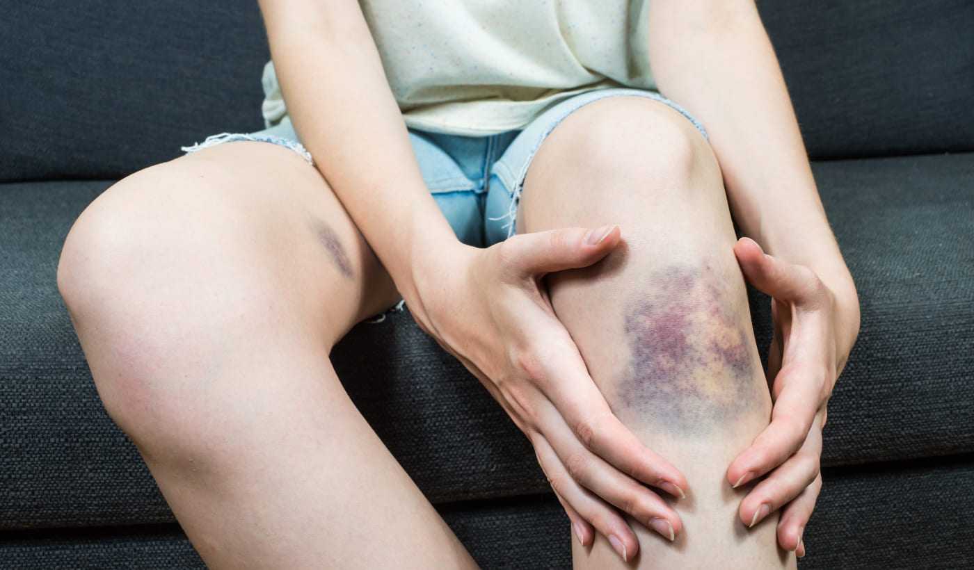 Terapia podciśnieniowa ran NPWT / VAC Warszawa i Płock | OpenMed