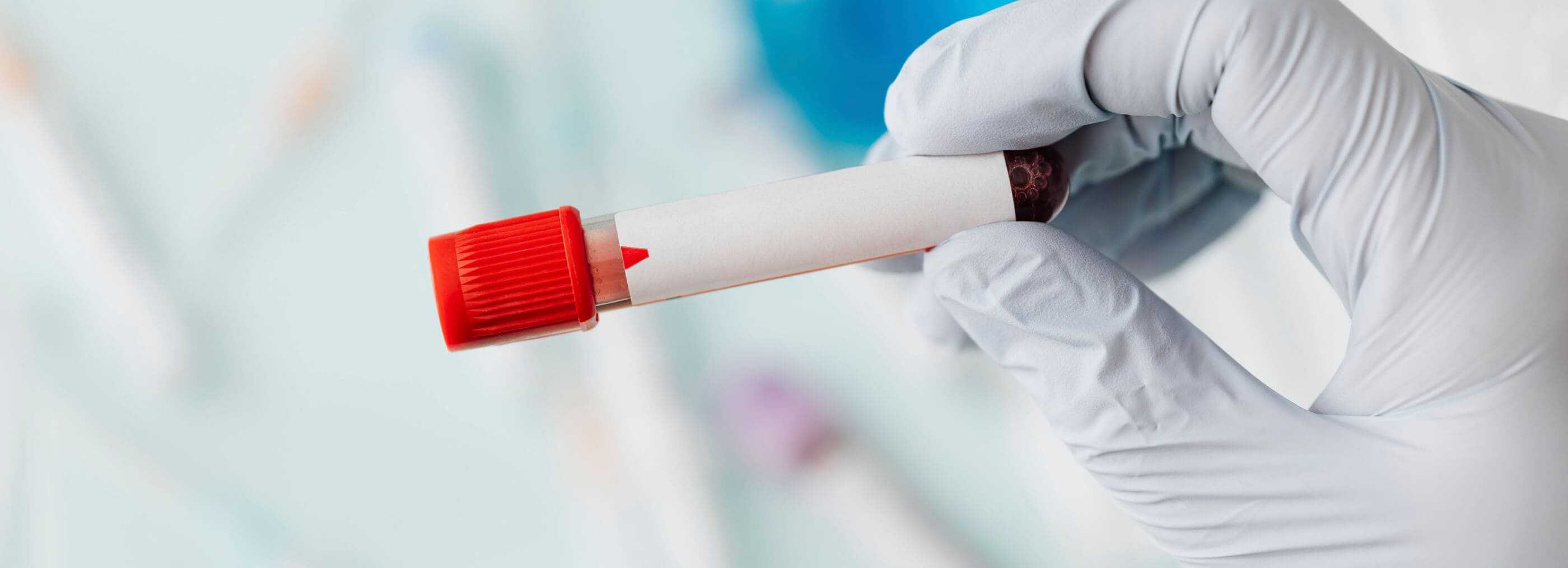 Diagnostyka zaburzeń krzepnięcia Warszawa Wola i Płock | OpenMed